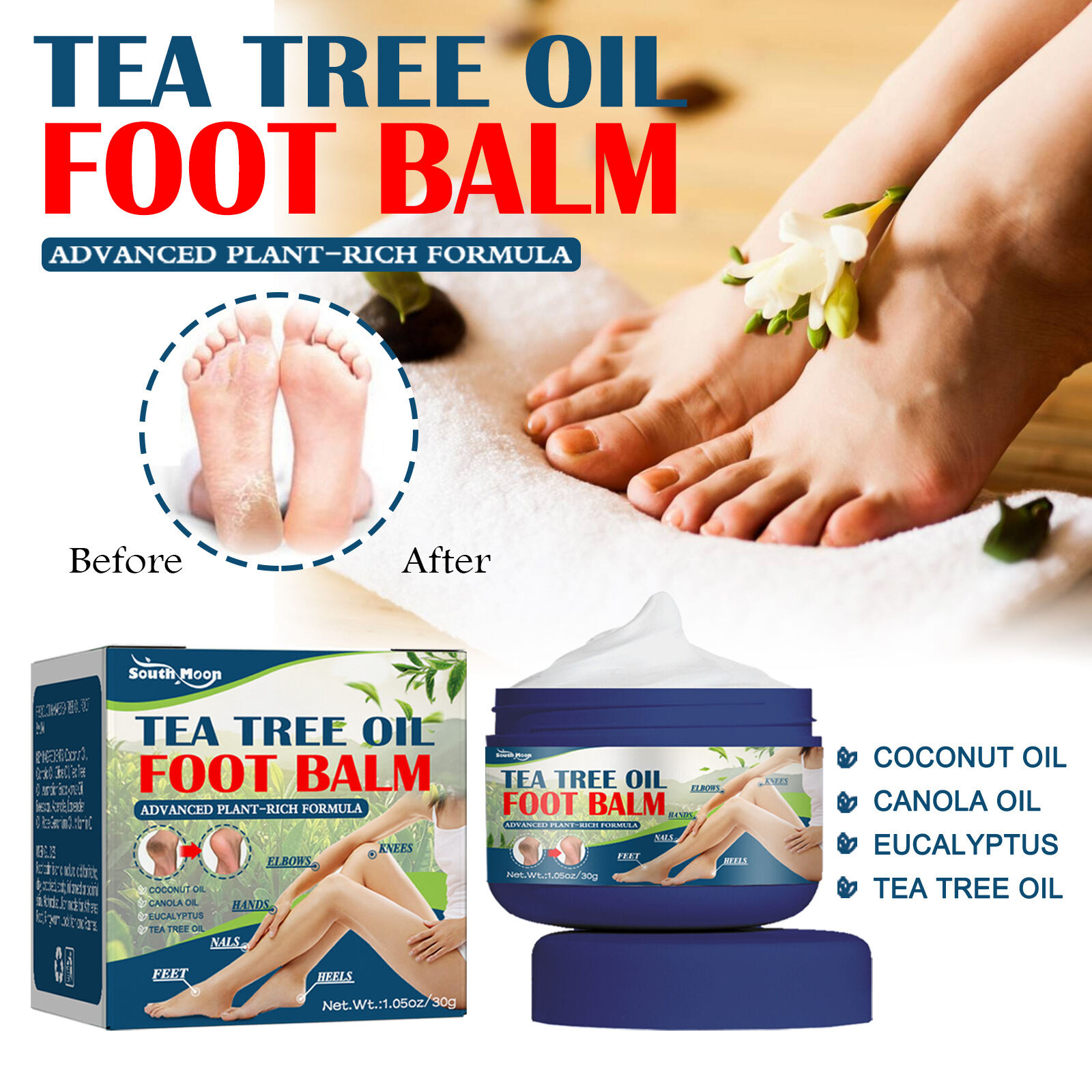 Urea Cream Anti-Drying Moisturizing Hand and Foot Cream Anti-Cracked Feet Urea Cream Heel Repair Exfoliating Dead Skin Exfoliating Moisturizing Moisturizing Smoothing Moisturizing Anti-Drying Hand Cre